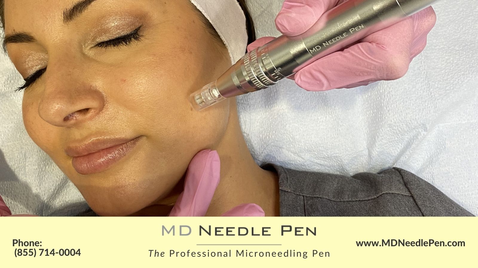 Is Microneedling Better Than Botox?