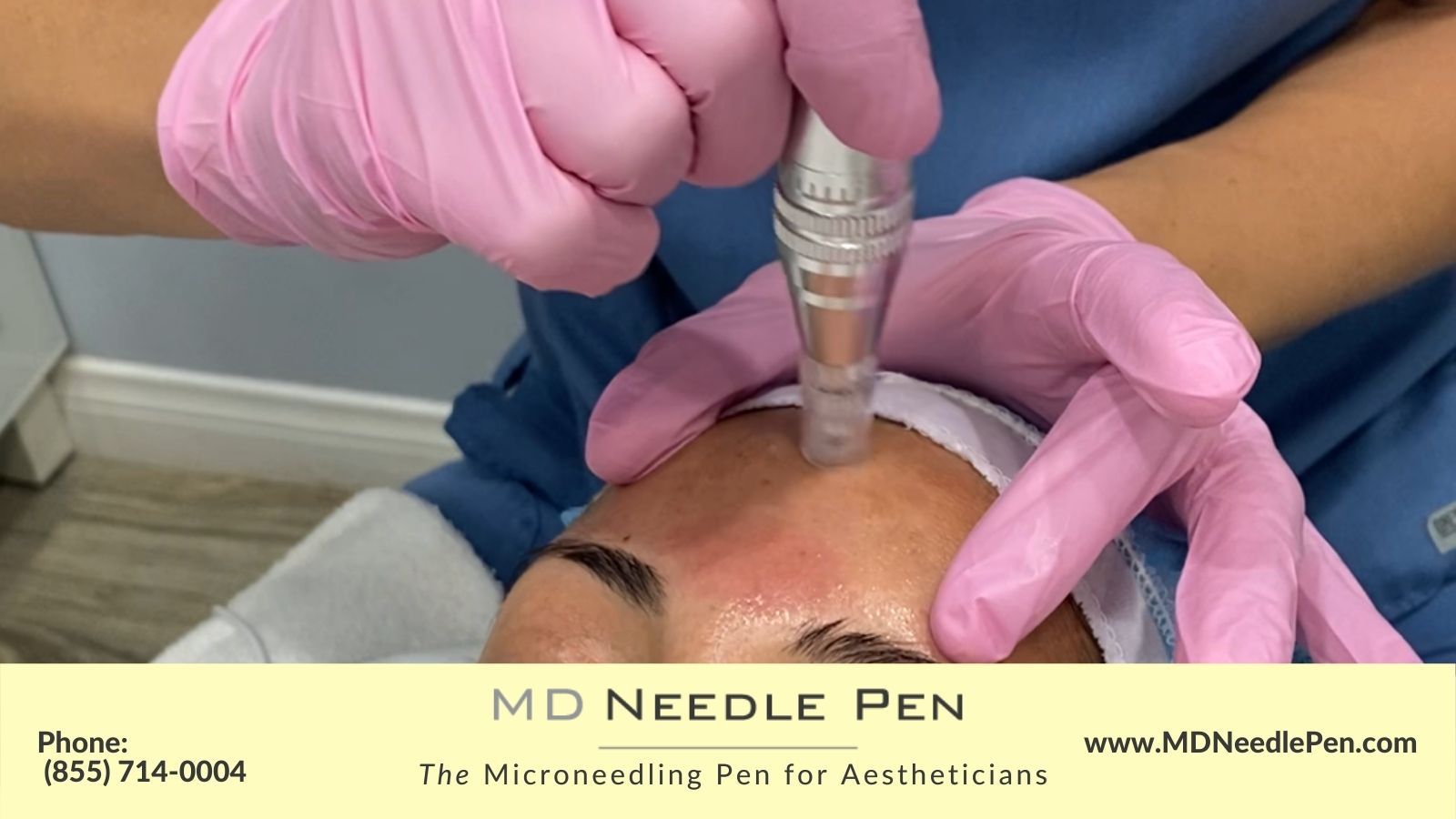 Microneedling